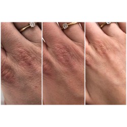 SWEDERM HUDSALVA VIT. E Maść do skóry suchej 50ml